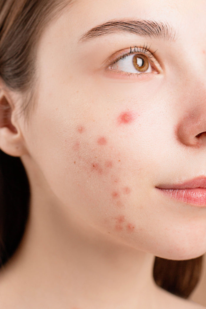 Before using SKINAURA